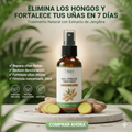 Spray Antihongos para Uñas 30ml