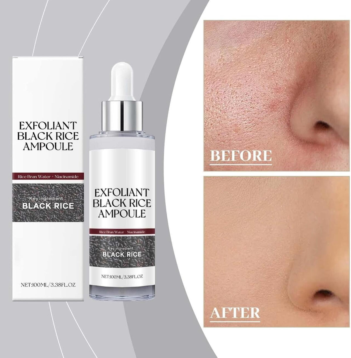 Ampolla Exfoliante de Arroz Negro 100ML – Renovación y Luminosidad Natural