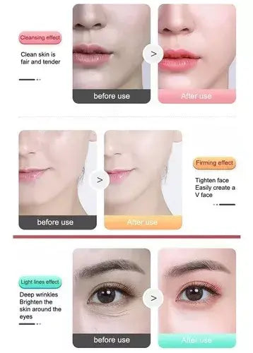Masajeador facial antiarrugas