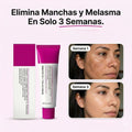 Crema Facial Iluminadora 50ML Arbutina 7% + Ácido Tranexámico 4%