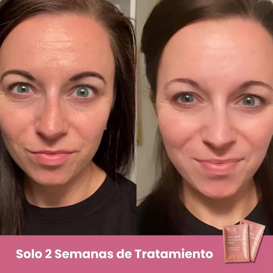 Mascarillas Biocolágeno - INCLUYE 5 Mascarillas