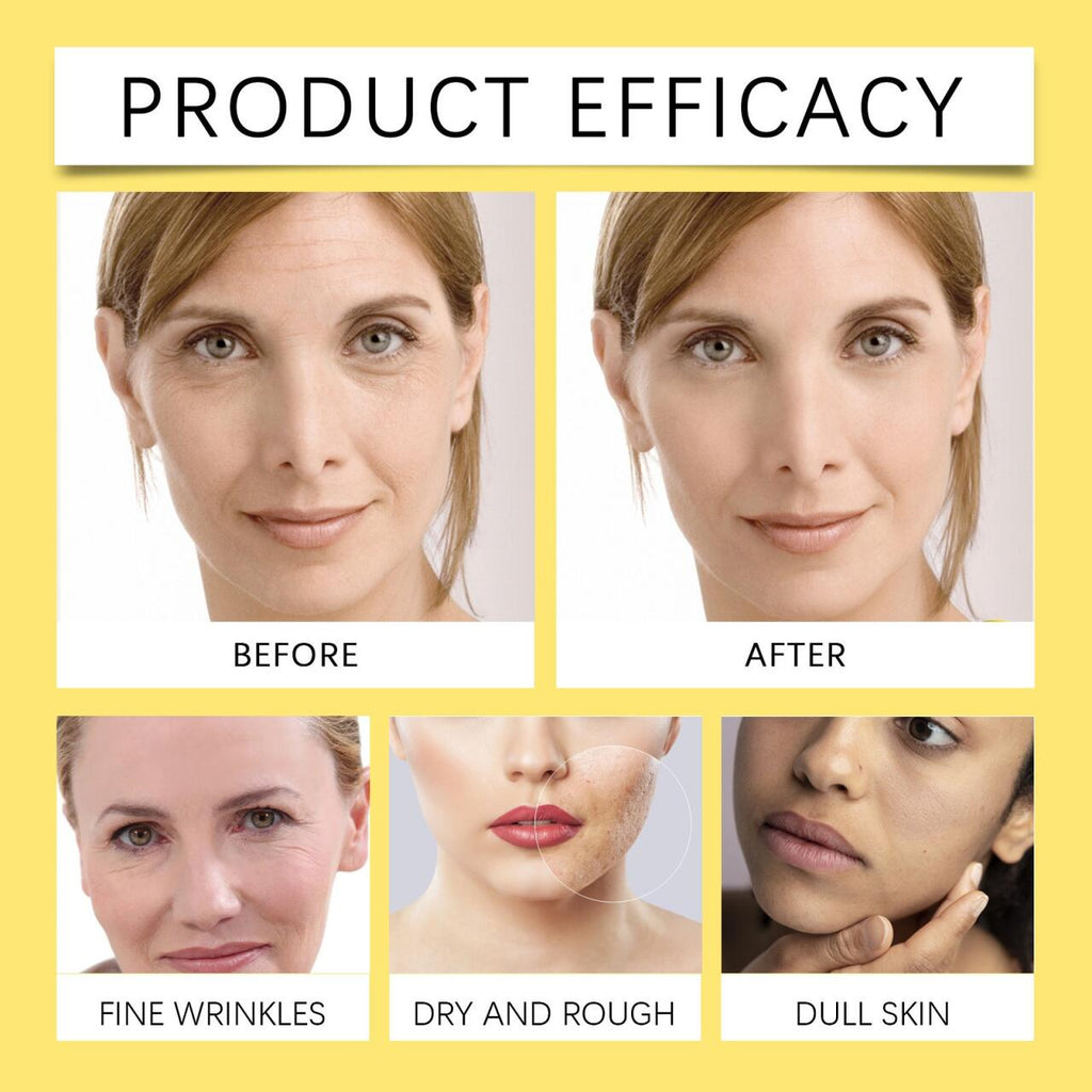 Crema Facial Caracol Advanced 92 100 Gr – Hidratación y Regeneración Profunda