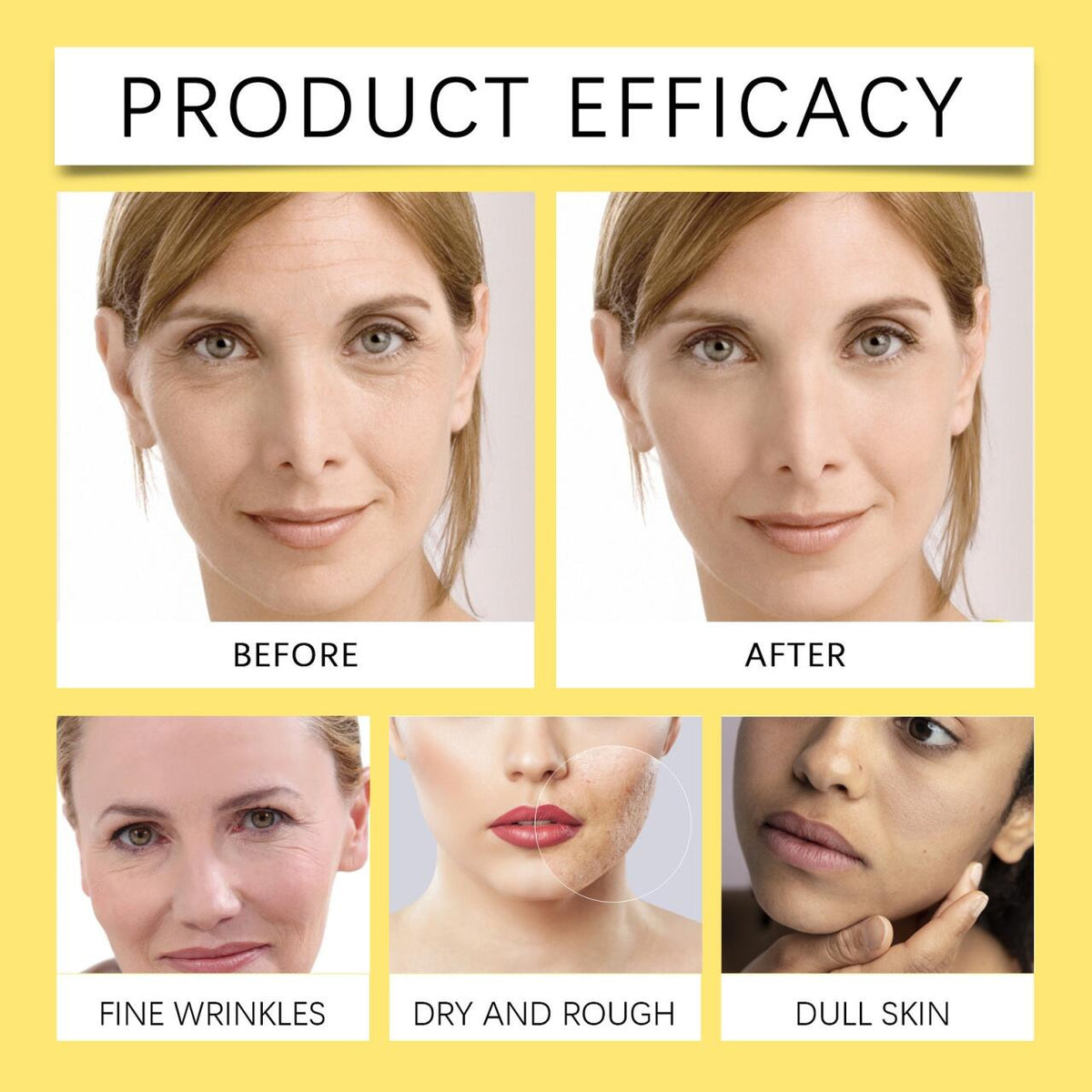 Crema Facial Caracol Advanced 92 100 Gr – Hidratación y Regeneración Profunda