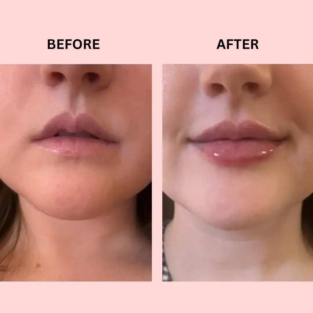 Lipboost Reafirmante Labios