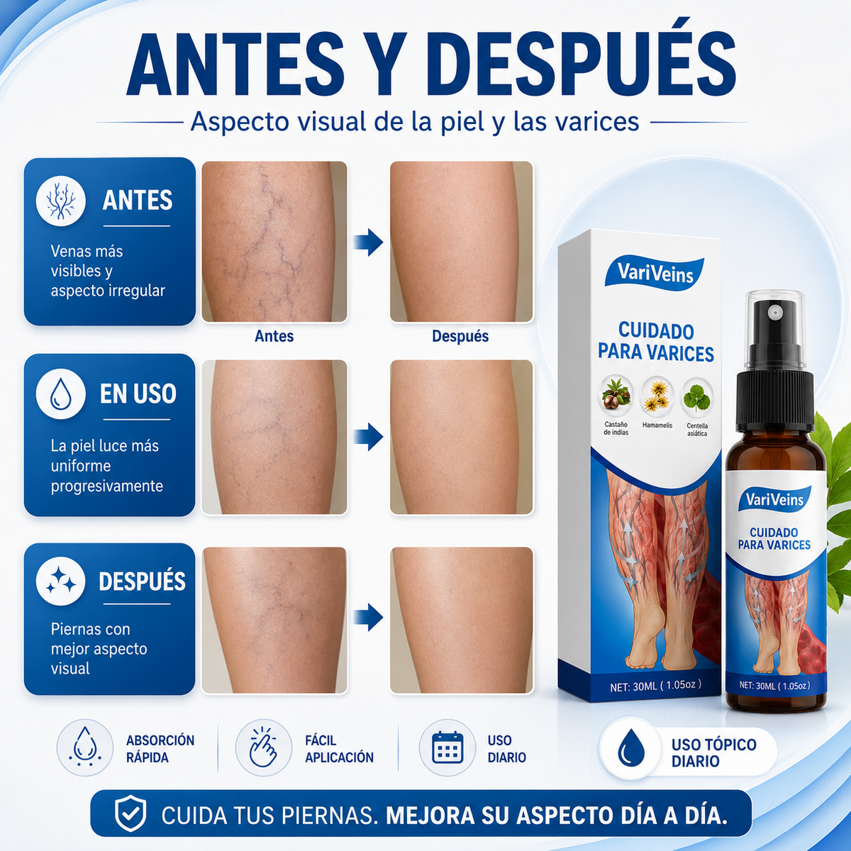 Spray para Varices