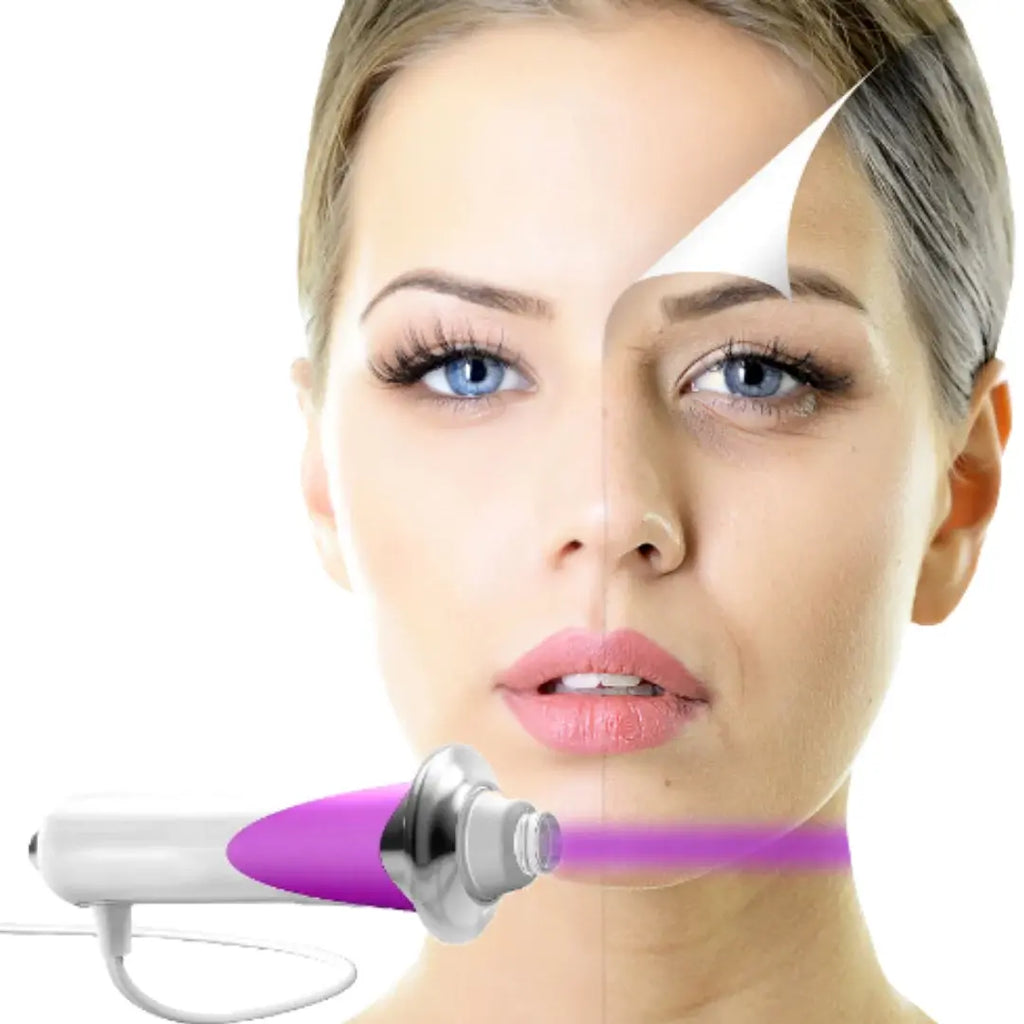 Beauty Stick Pro – Dispositivo Antienvejecimiento de Microcorriente